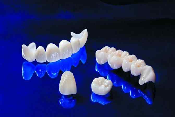 osobennosti-ustanovki-koronok-na-perednie-zuby
