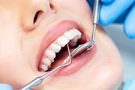 ustanovka-implanta-zuba